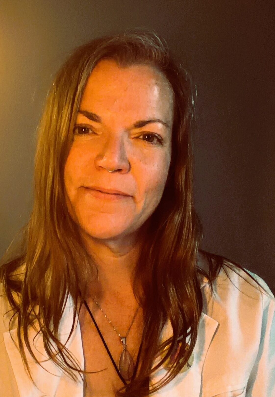 Acupuncture with Tessa Bound, R.Ac